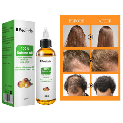 Nutrivibe Batana Oil 120ml nourishes hair, supports growth, restores shine, and promotes scalp health naturally.